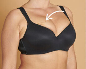 poverty The office Articulation overflow bra with time dose assist