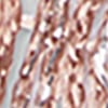 Dressy Crochet Poncho, rose gold, swatch